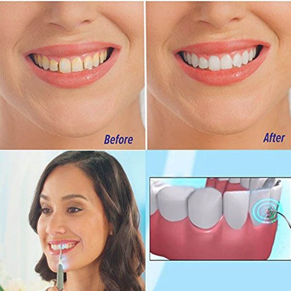 Irrigador Dental HydroClean Pro™ + ¡Regalo Lápiz Blanqueador!